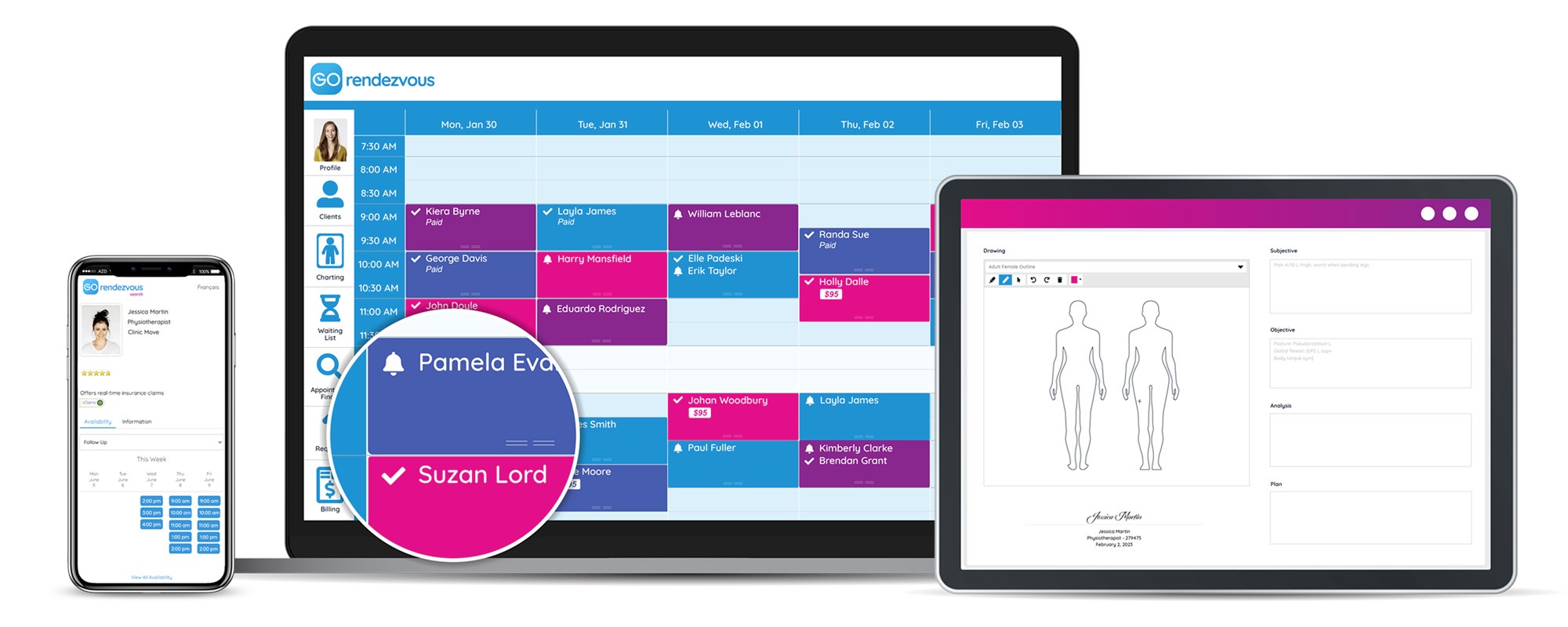 A view of an orthotherapist's GOrendezvous schedule on different devices